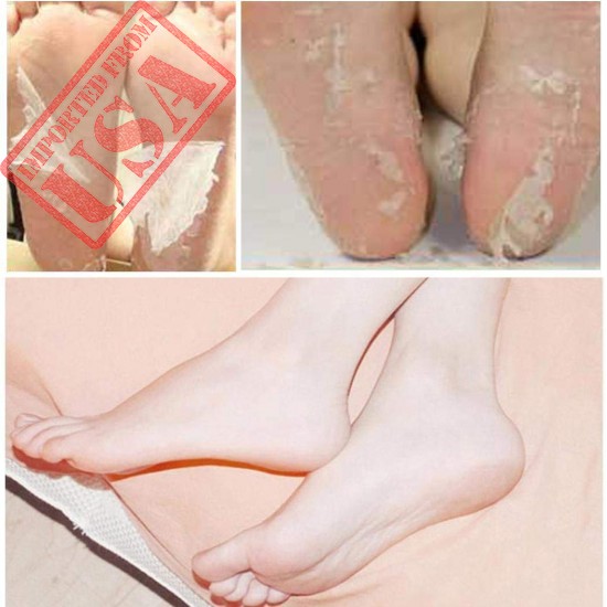 Get online Best Quality Foot Peel Mask in Pakistan 